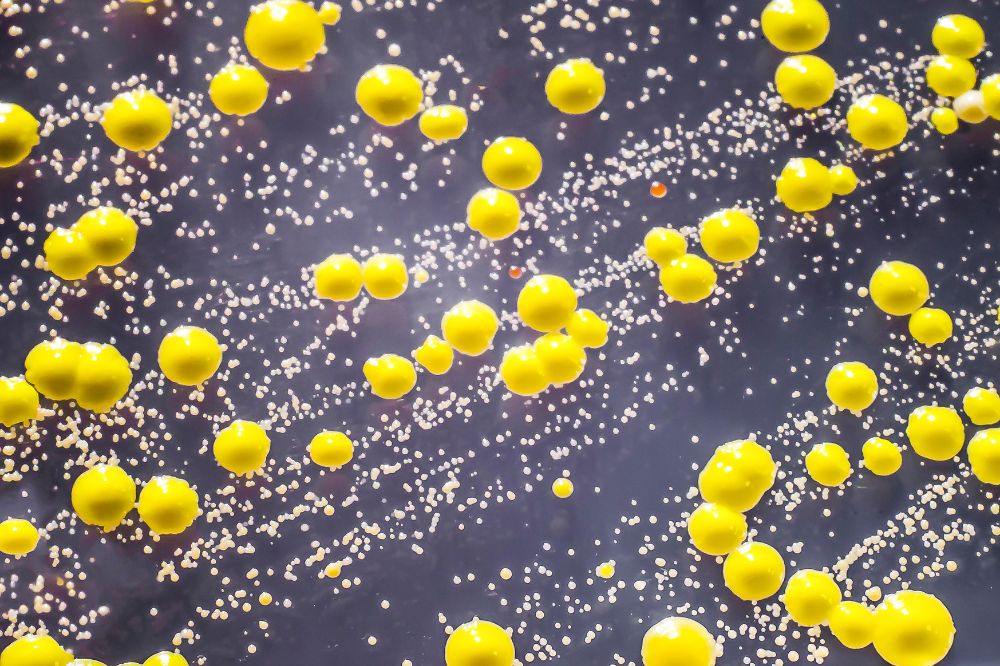 Micrococcus luteus