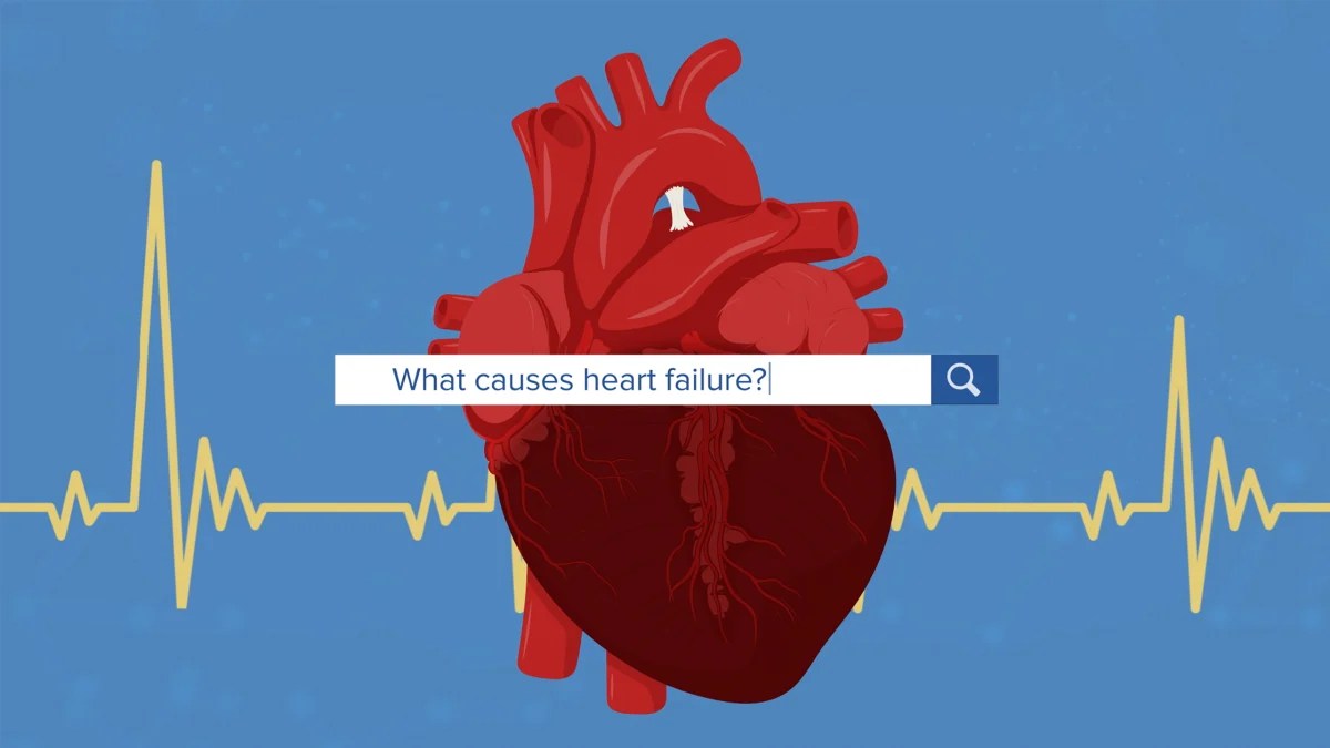 Comprehensive Guide to Congestive Heart Failure (CHF)