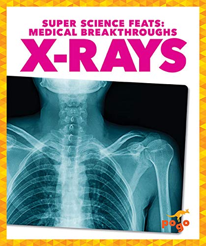 White skeleton of chest and neck glows against a blue outline of a human body, against a black background. Text reads: Super Science Feats: Medical Breakthroughs: X-Rays