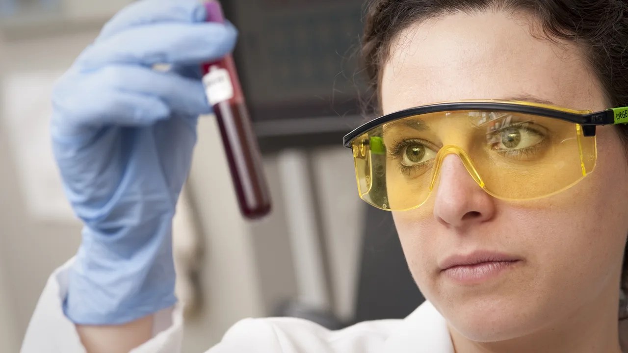AI Blood Test Predicts Heart Disease Up to 15 Years Before Symptoms