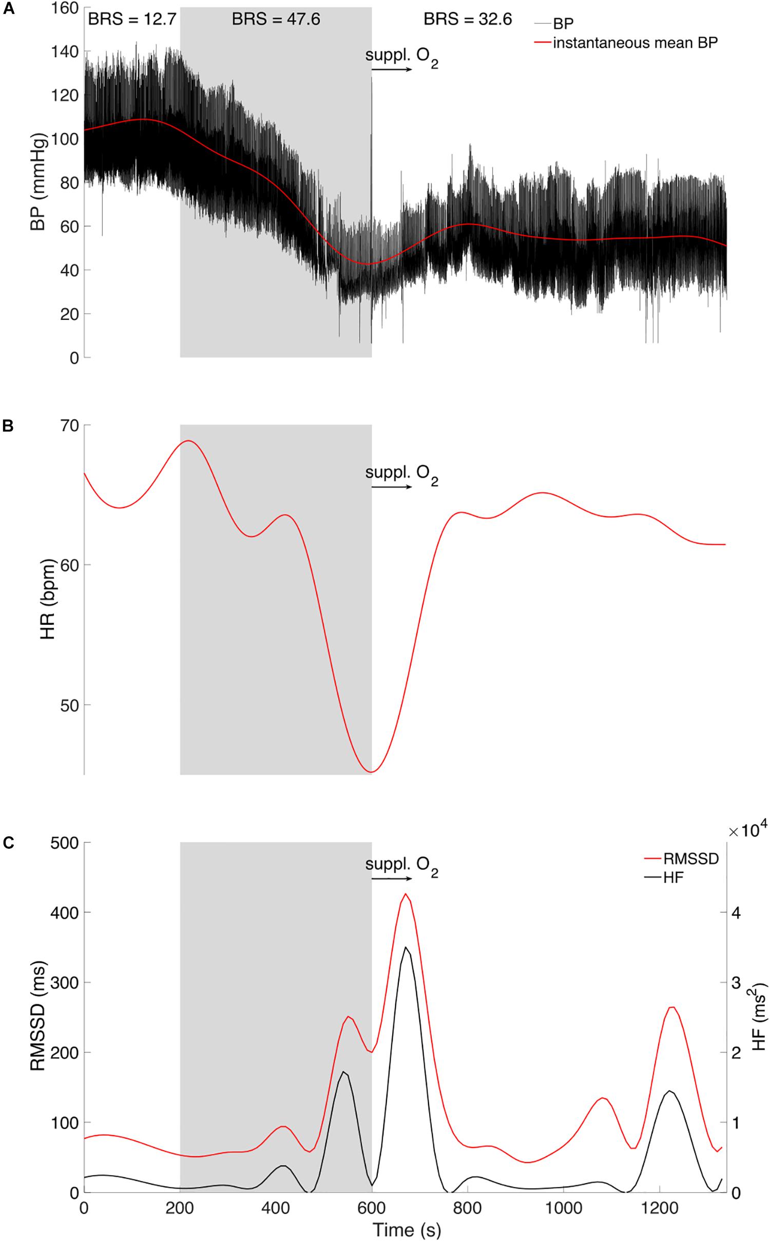 Frontiers | Cardiovascular And Cerebral Responses During A Vasovagal Reaction Without Syncope | Neuroscience Frontiers | Cardiovascular And Cerebral Responses During A Vasovagal Reaction Without Syncope | Neuroscience