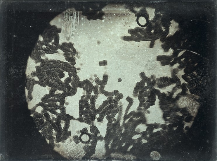 Microscopic view of mold spores and fungal structures, showing detailed patterns under magnification