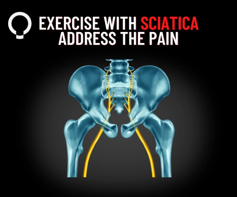 Top 3 Tips For Sciatica Functional Patterns - Gradient Wallpapers - Beautiful 4K Collection