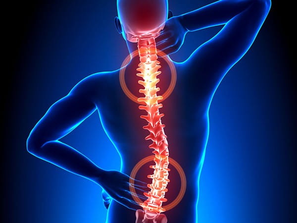 GitHub：Rehabilitation Guide 颈椎病腰突康复指南