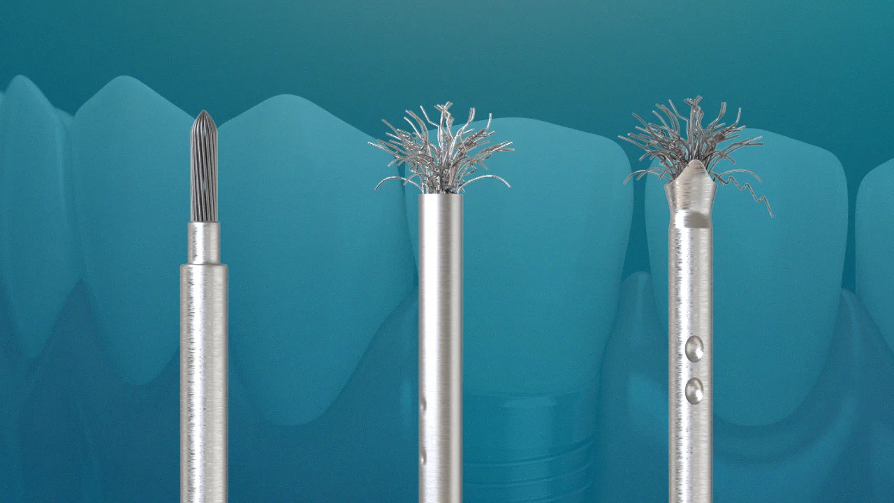Dental Implant Surface Cleaning Brush - GDT Dental Implants