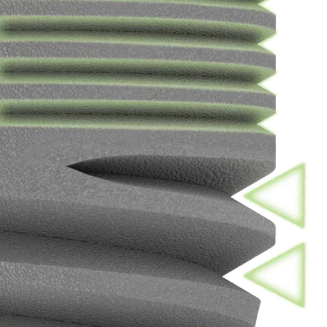 Detailed close-up of GDT CFI dental implant thread profile and surface texture.