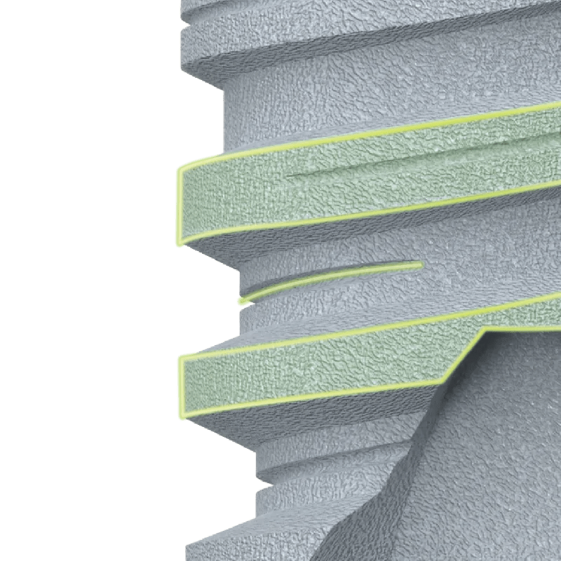 GDT CON dental implant aggressive apical threads for enhanced bone engagement and stability