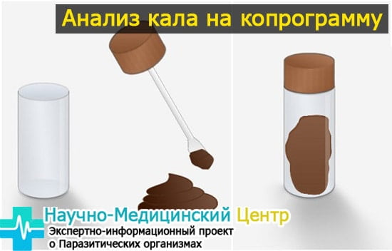 Что съесть чтобы сдать анализ кала. Анализ кала: как правильно сдавать и какие анализы существуют. Как правильно сдавать анализ кала: правила сбора, хранения и транспортировки кала Во что можно сдать анализ кала