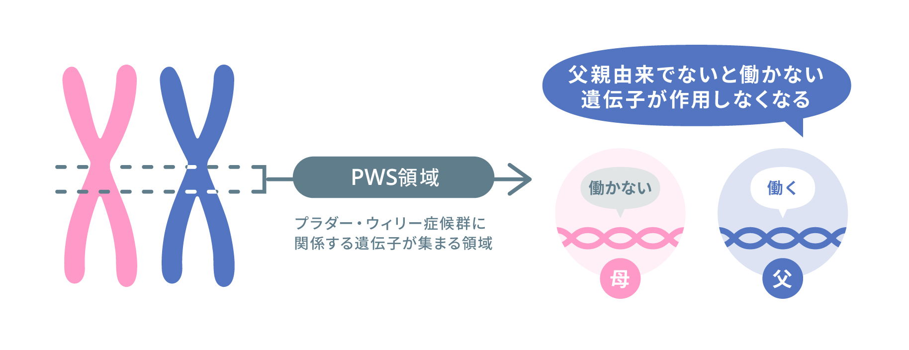 プラダー ウィリー 症候群