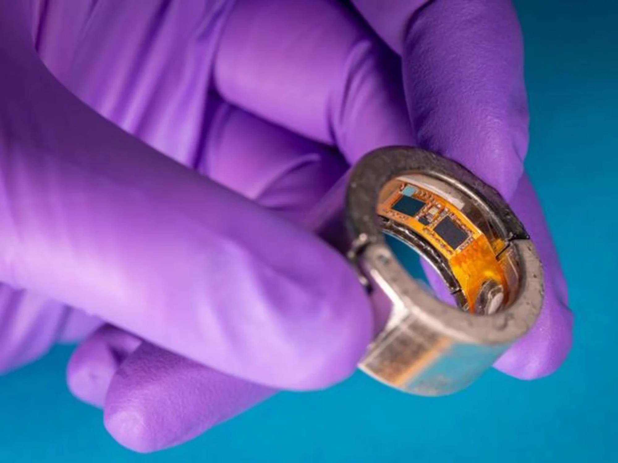 CHARM: Neuer Smart Ring misst Blutzucker im Schweiß