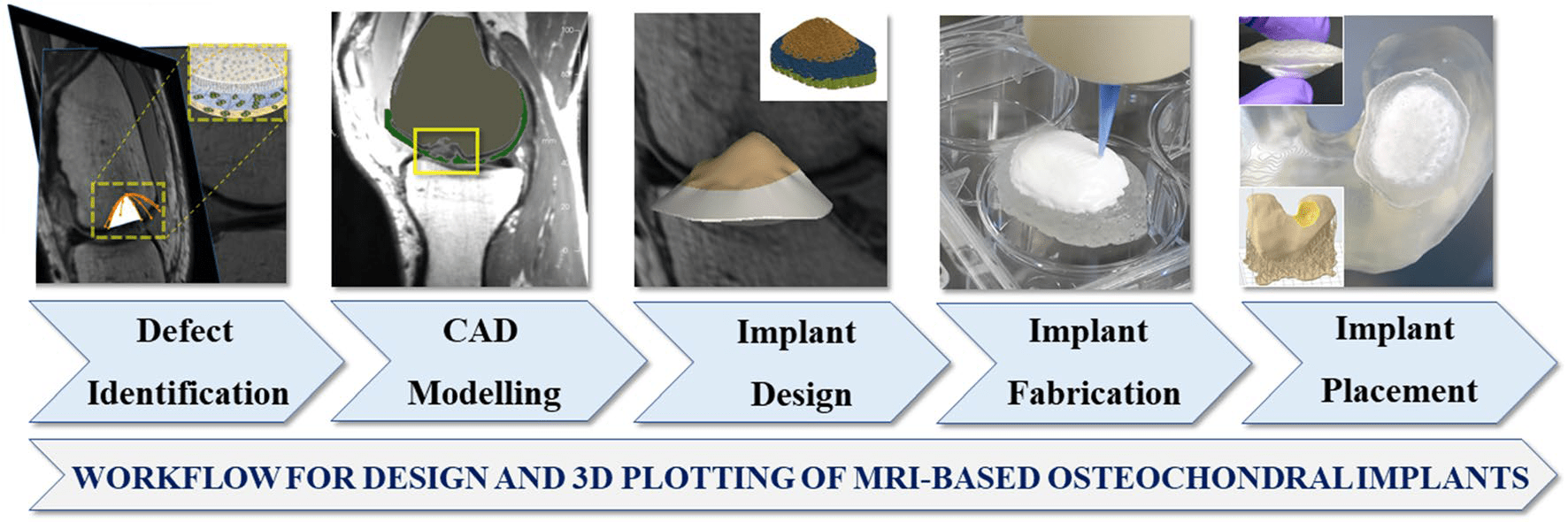 3d printing is a method of manufacturing everything from tools to shoes to jewelery, or even car and aerospace parts. 3d Printing Of Multi Layer Scaffolds For Patient Specific Implants