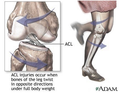 How is a pcl injury different from an acl injury?