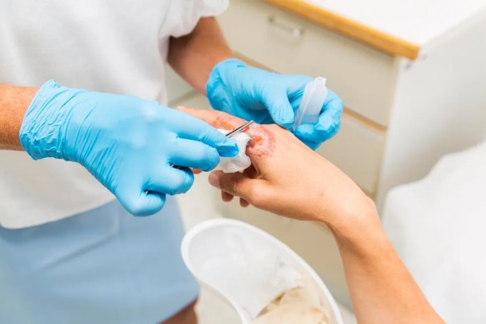 How Does Poor Nutrition Affect Wound Healing? How Does Poor Nutrition Affect Wound Healing?