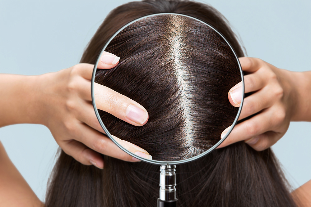 Start at the root: scalp health and hair loss