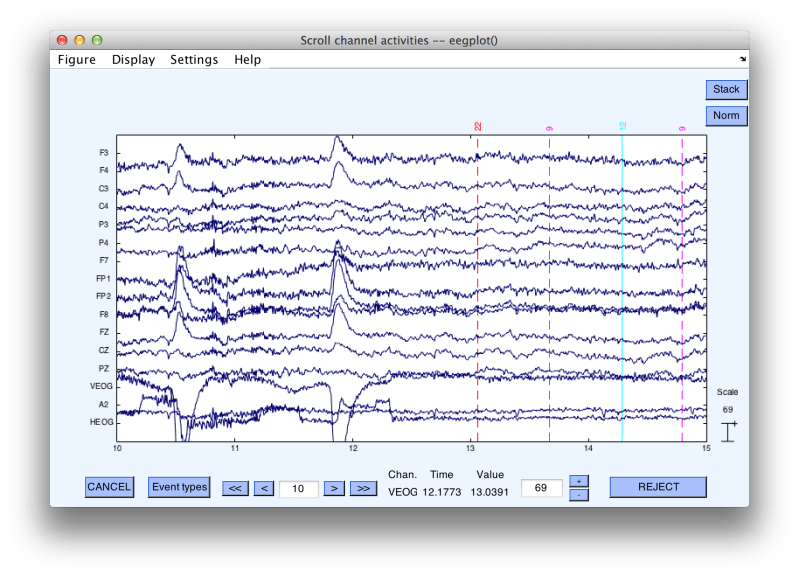 Signal Processing Toolbox In Erplab Ucdavis Erplab Github Wiki - Amazing Gradient Photo - Retina
