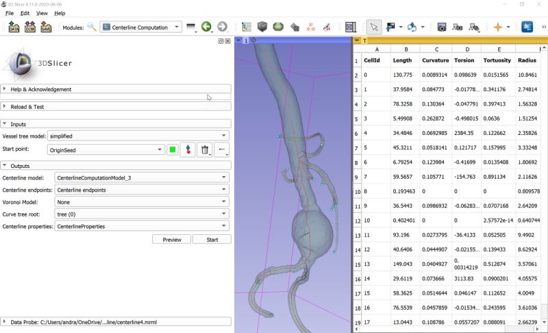Github Vmtk Slicerextension Vmtk - Creative High Resolution Gradient Patterns | Free Download