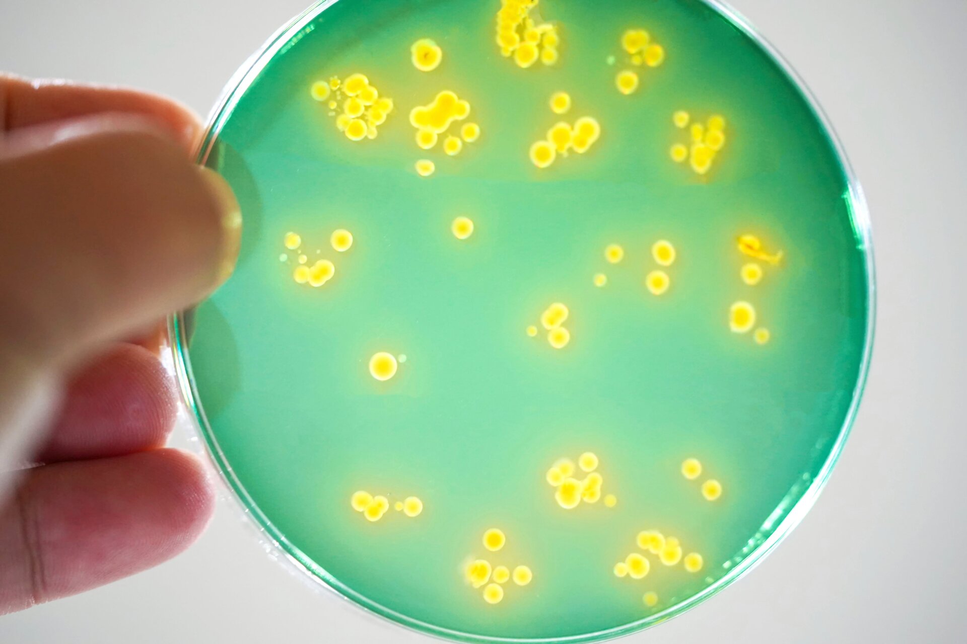 Summer's Deadly Threat: 'Flesh-Eating' Bacteria on the Rise (2026)