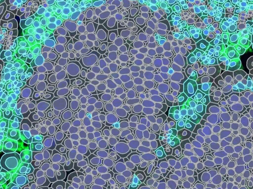 Immunofluorescent IF pathology image Analysis 