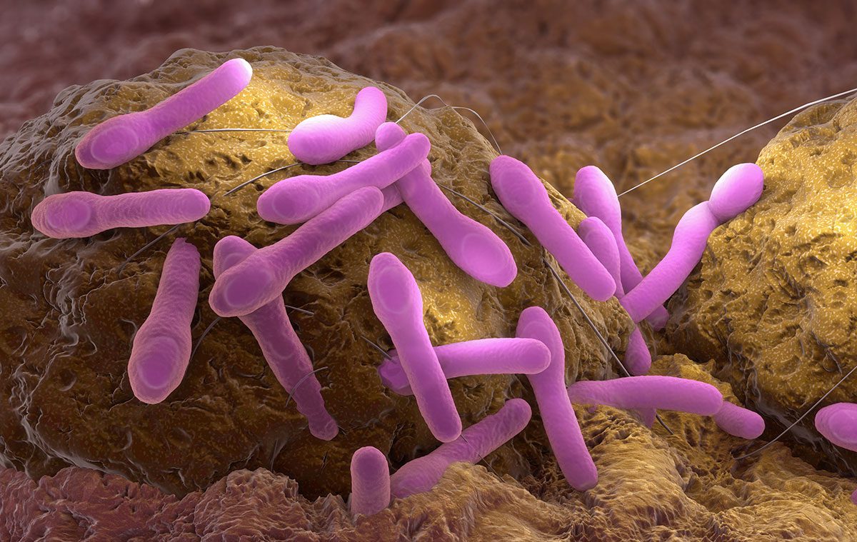Revolutionary New ELISA Test Boosts Botulism Detection in Food: A Game-Changer for Public Health and Biodefense Revolutionary New ELISA Test Boosts Botulism Detection in Food: A Game-Changer for Public Health and Biodefense