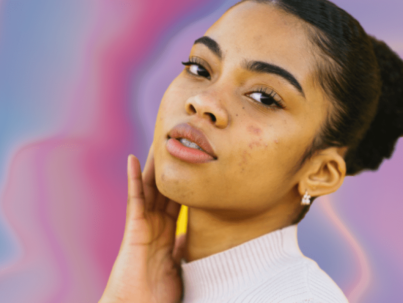 Back-to-school breakouts? A derm shares how to tackle acne with confidence – National