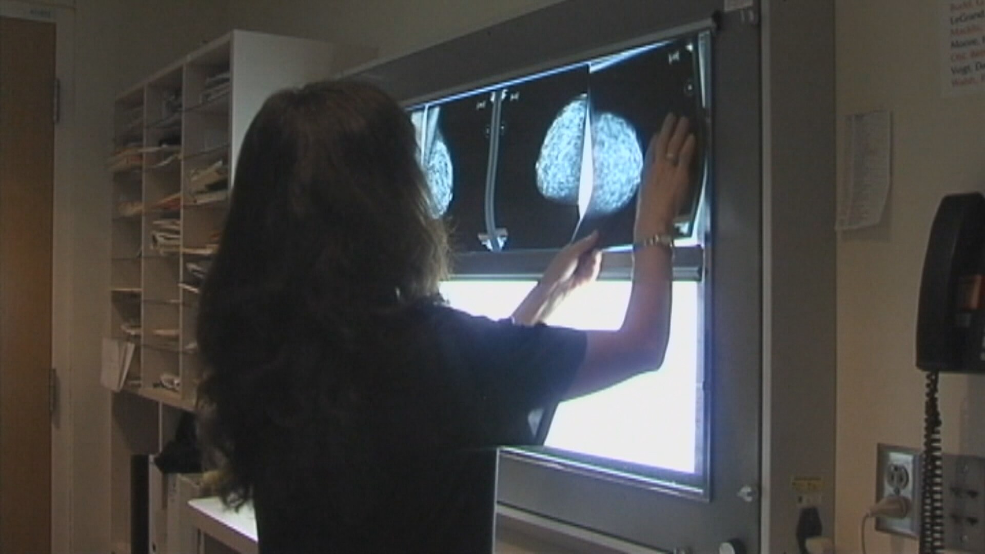 A iniciativa contra o câncer de mama que envia pacientes para Alberta está reduzindo Sask. lista de espera