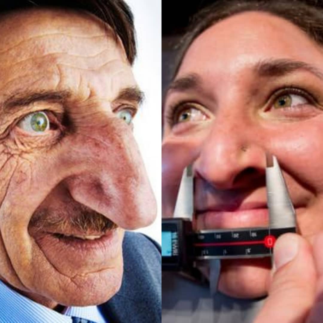 L Homme Le Plus Gros Nez Du Monde Voici l'homme et la femme ayant les plus gros nez du monde - Gnadoe