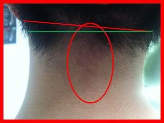 visual neck