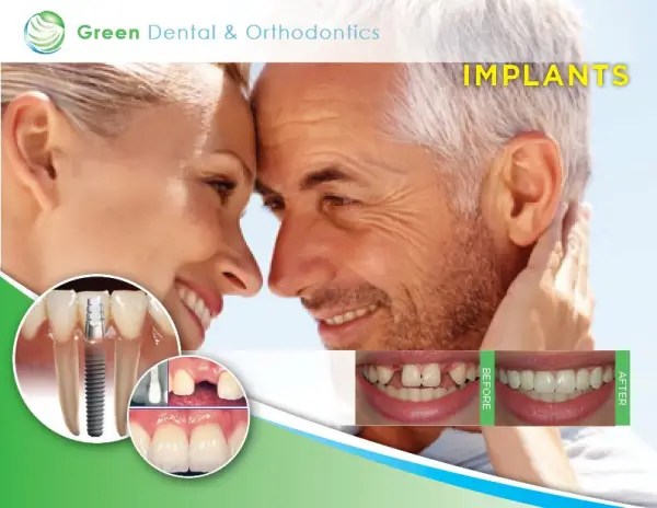 Same Day Dental Implants