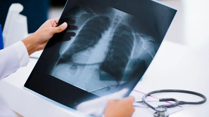 x-rays-Υπηρεσίες-Εμπιστευτικής-Καταστροφής