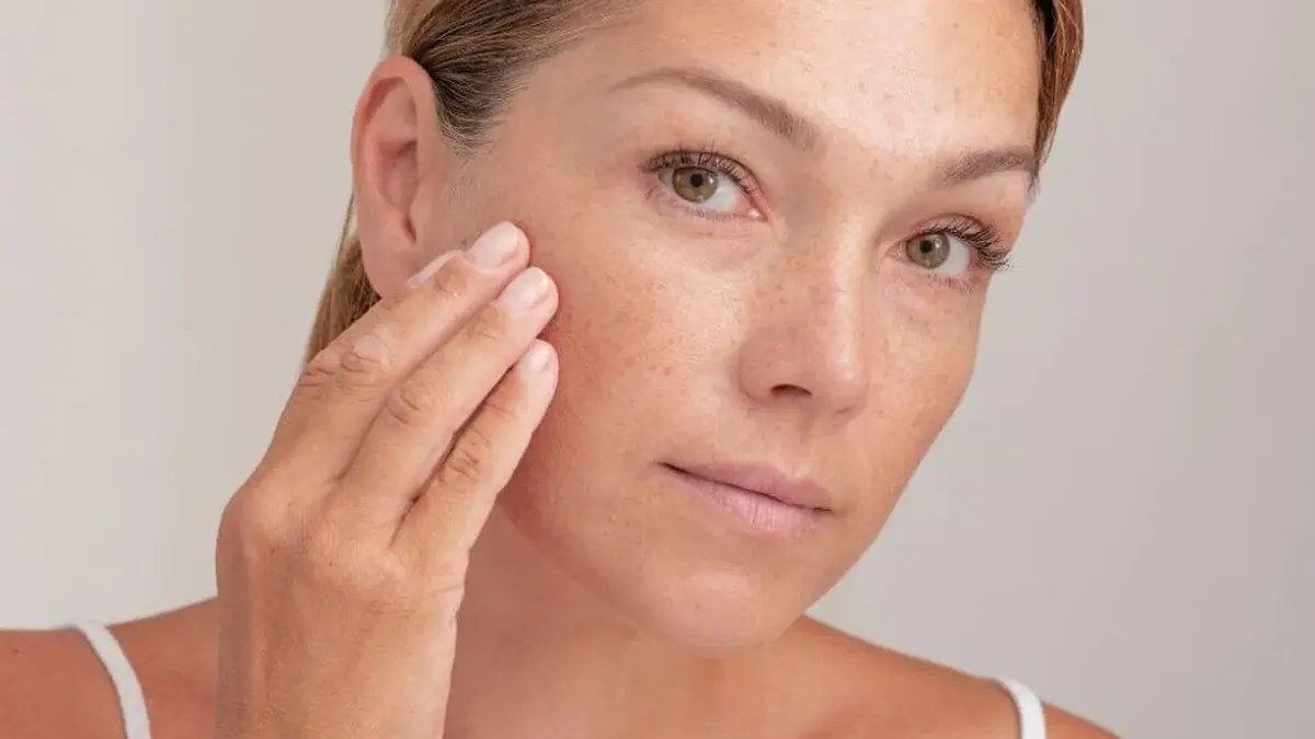 प्याज से स्किन की झाईयां करें कम, बेदाग नजर आएगा चेहरा: Onion for Pigmentation