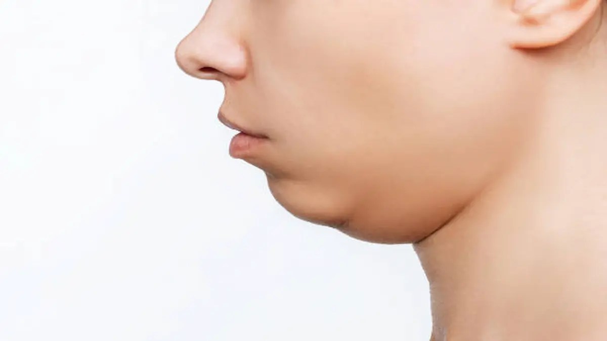 Tips To Get Rid Of Double Chin