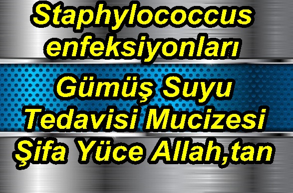 Metal background with blue perforated element. Vector 3d illustration