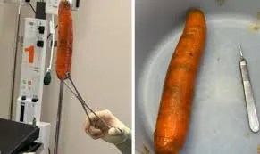 Doctor Warns Against Inserting Foreign Objects Anally