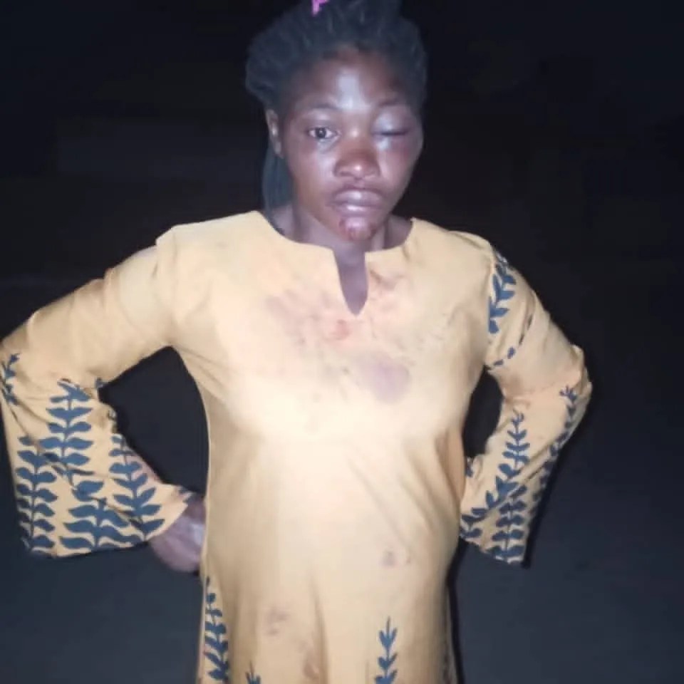 Eight-Months Pregnant Woman Allegedly Assaulted by Husband in Benue State