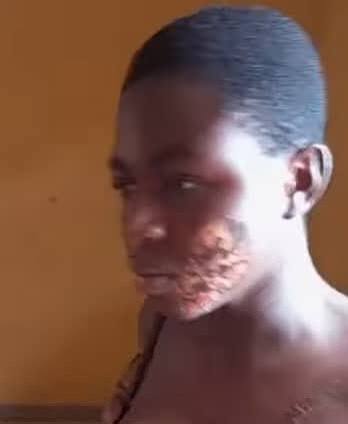 Woman Arrested for Allegedly Torturing 17-Year-Old Maid with Hot Iron in Anambra