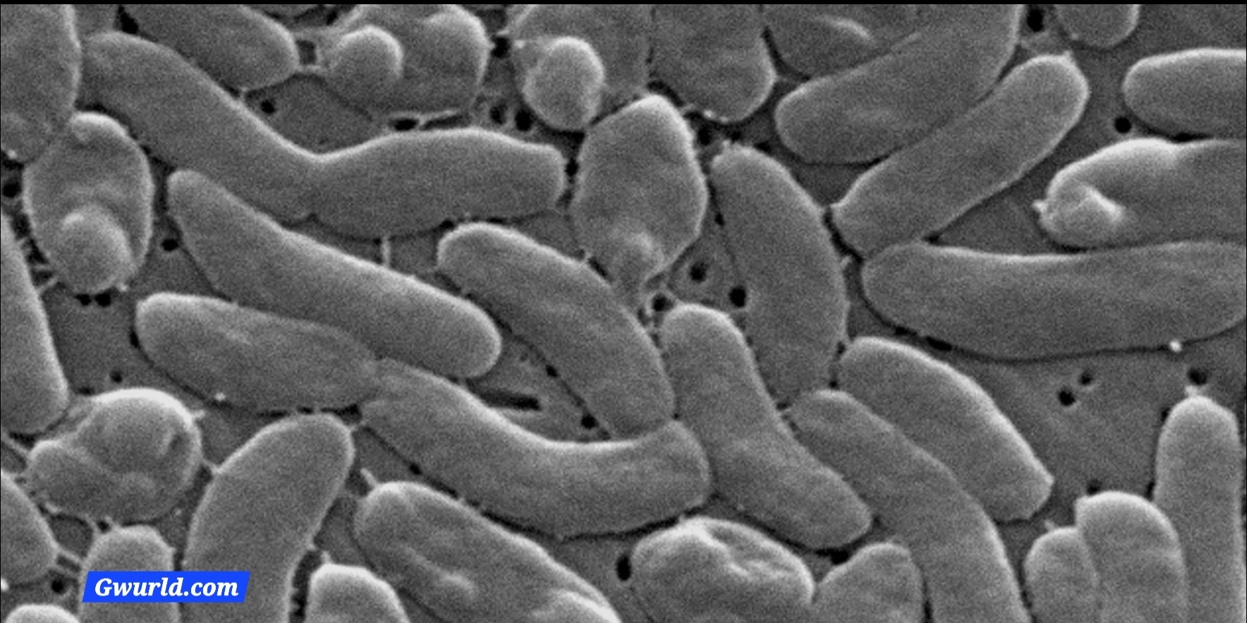 Flesh-Eating Bacteria Outbreak Leaves 5 Dead and 4 Hospitalized, Health Officials Warn