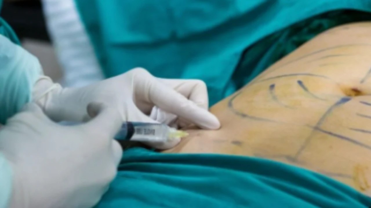 Cirugía clandestina: médico es judicializado por la muerte de una mujer en Medellín