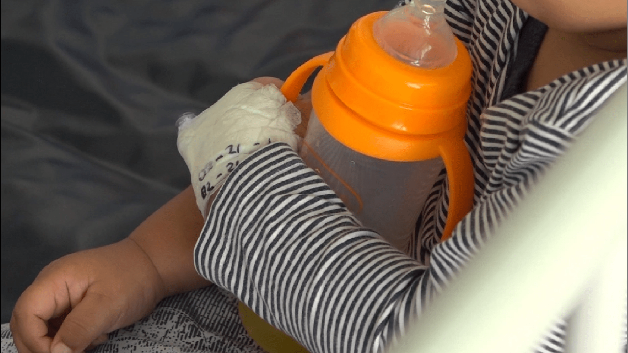 ¡Qué lindo! 60 niños de Antioquia recibirán cirugías plásticas y reconstructivas para corregir malformaciones