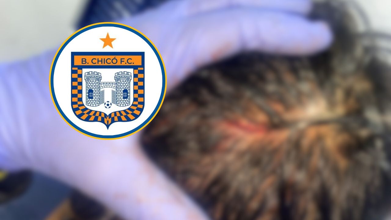 VIDEO: Quedó echando sangre, Boyacá Chicó denuncia supuesta agresión de futbolistas de Millonarios