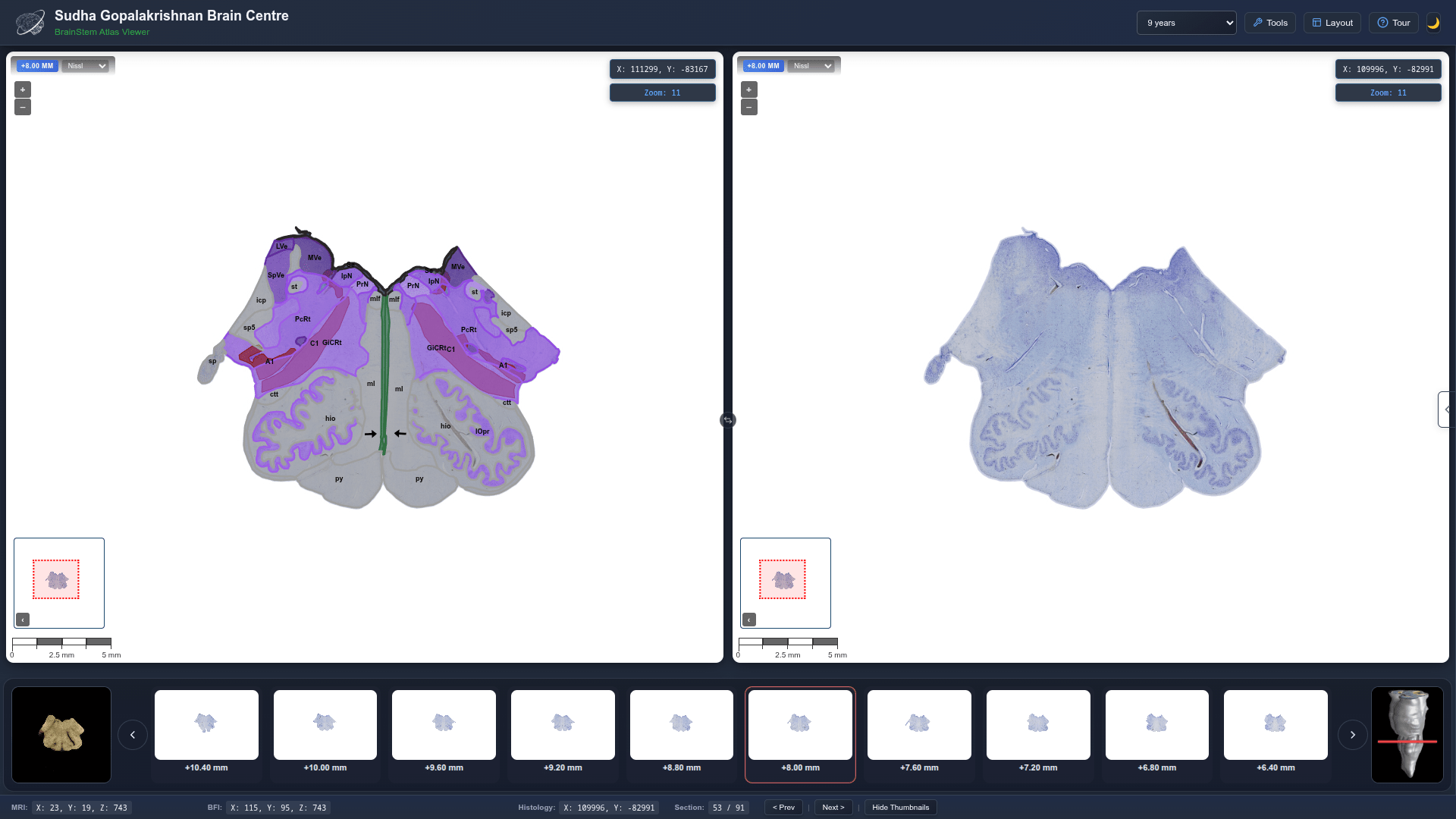 Groundbreaking Brainstem Map by Indian Scientists | 3D Model for Neurological Research (2026)