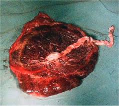 Placenta