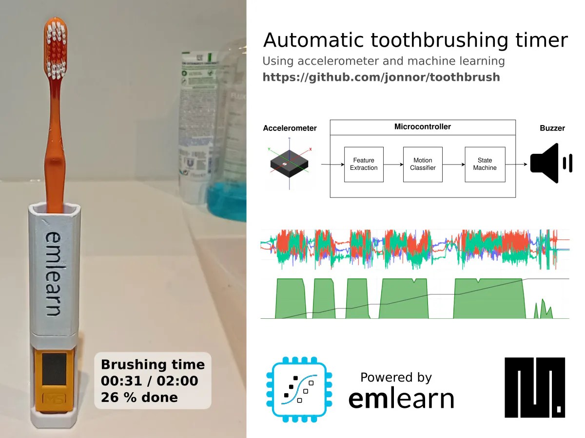 Automatic Toothbrush Timer Hackster Io