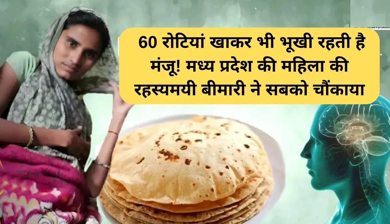 Binge Eating Disorder: 60 रोटियां खाकर भी भूखी रहती है मंजू! मध्य प्रदेश की महिला की रहस्यमयी बीमारी ने सबको चौंकाया