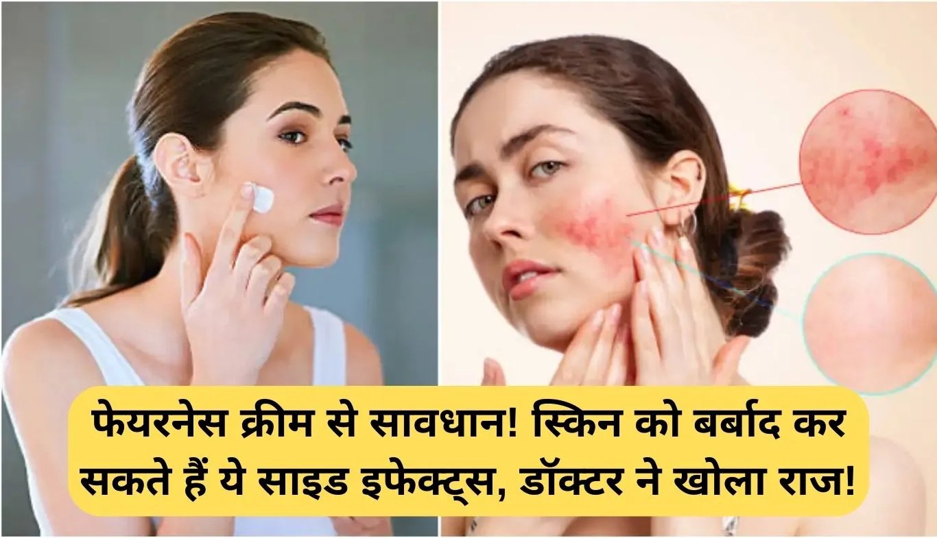Fairness Cream Side Effects: फेयरनेस क्रीम से सावधान! स्किन को बर्बाद कर सकते हैं ये साइड इफेक्ट्स, डॉक्टर ने खोला राज!