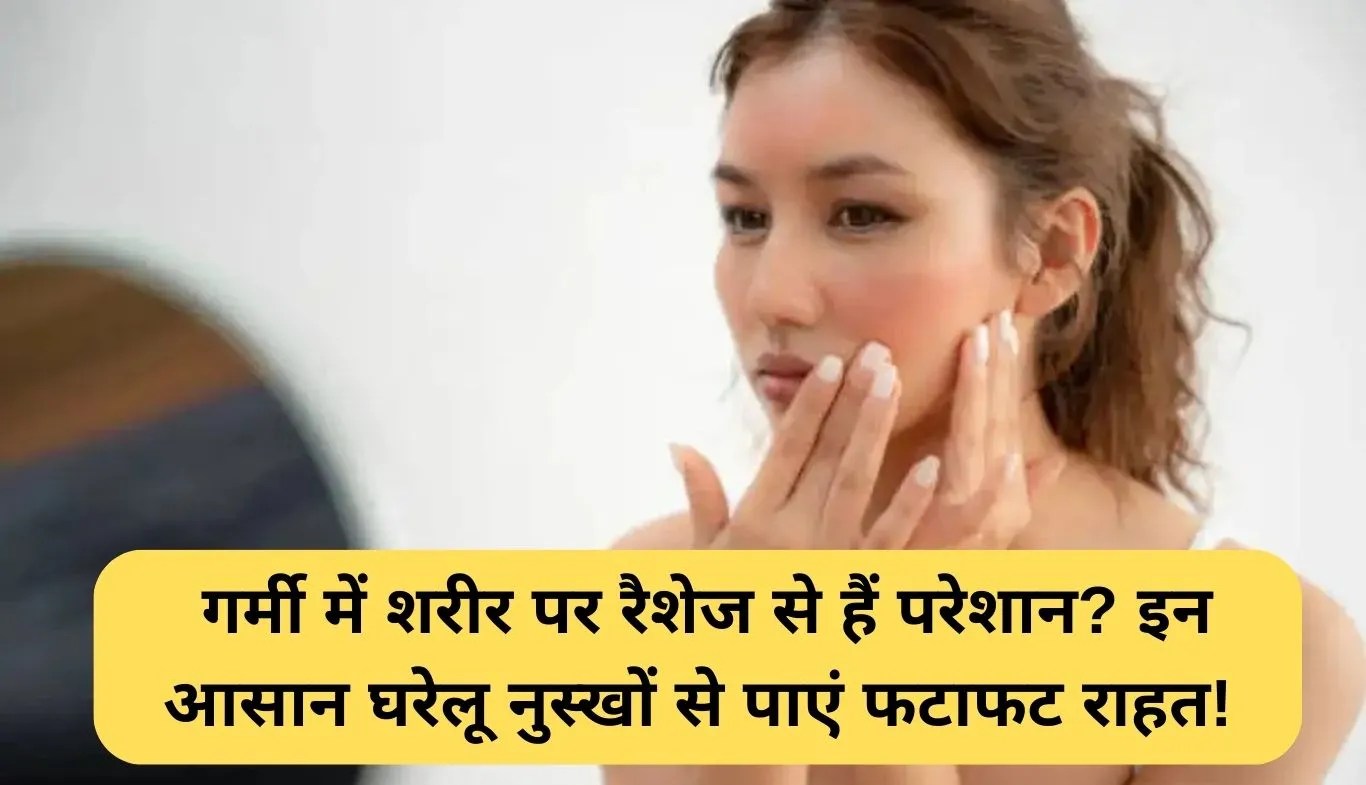 Summer Rashes Home Remedies: गर्मी में शरीर पर रैशेज से हैं परेशान? इन आसान घरेलू नुस्खों से पाएं फटाफट राहत!