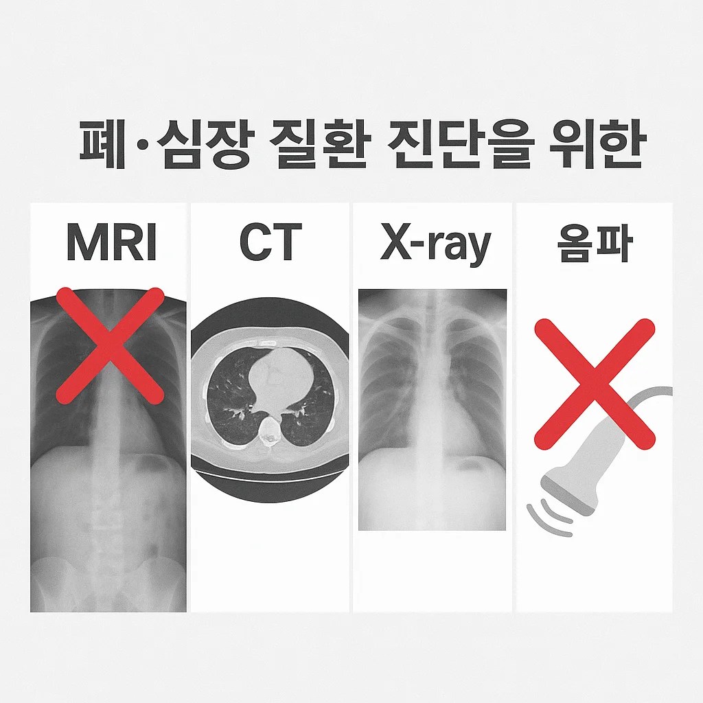 흉부 질환에서 MRI CT X-ray 초음파 비교