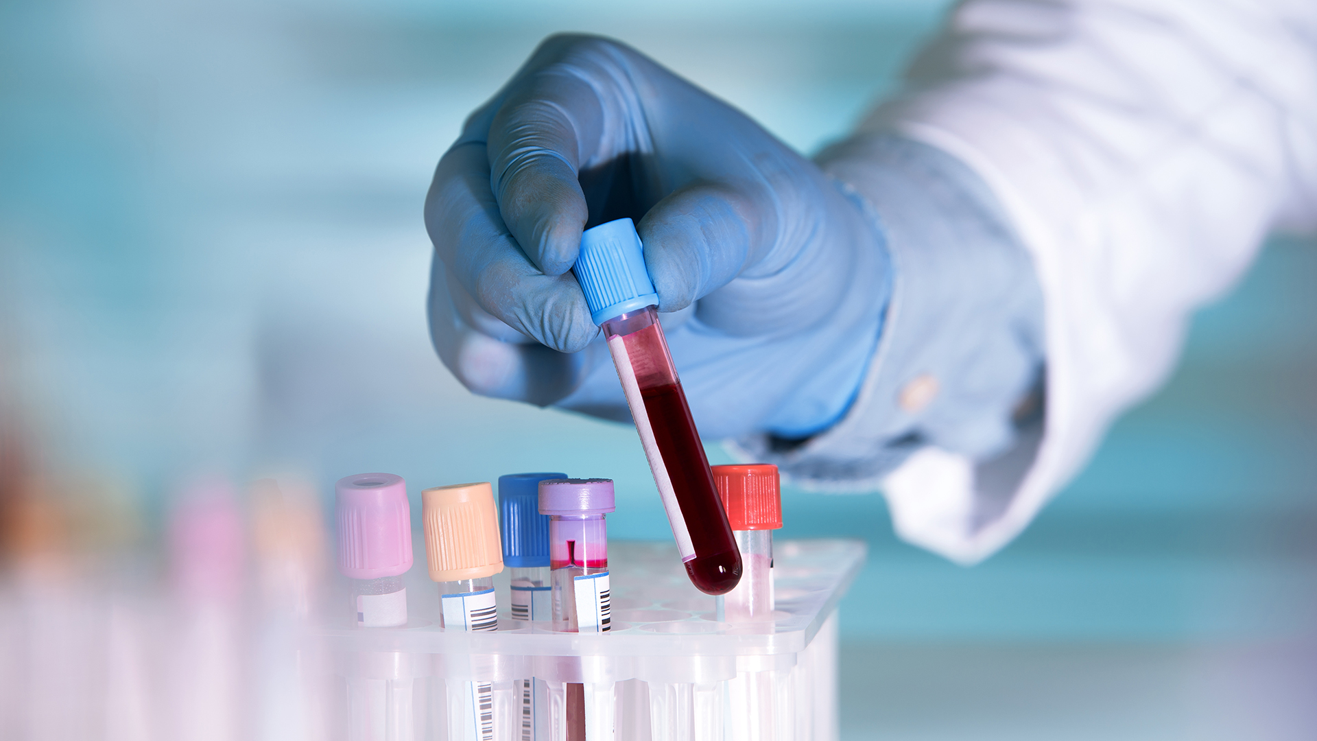 Uncovering the Invisible Error: How Process Failures Impact NHS Patients (2026)