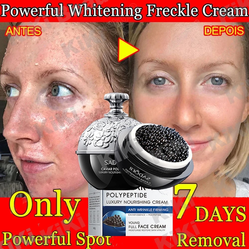 Effective Whitening Freckle Remove Melasma Cream Caviar Face Cream Remove Dark Spots Melanin Brighten Repair Skin Care Products
