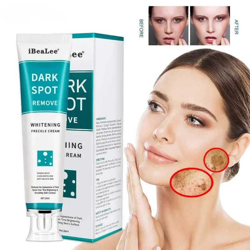 Whitening Freckles Cream Remove Melasma Dark Spots Lighten Melanin Remover Moisturizing Brightening Face Skin Care 20ml