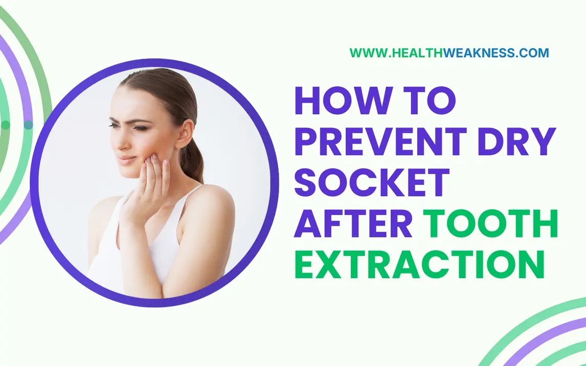 Preventing Dry Socket After Tooth Extraction